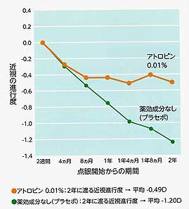 目に関するあれこれ：近視の進行を抑える目薬「マイオピン」をご存知ですか？